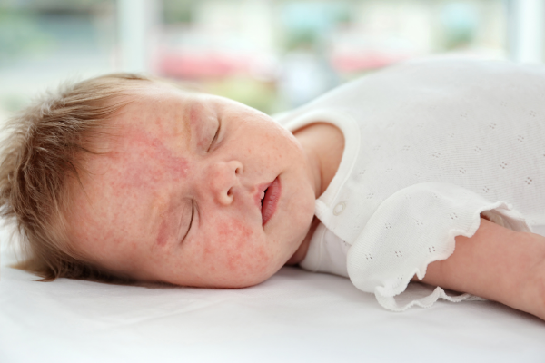 coconut oil on babies